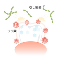 フッ素塗布