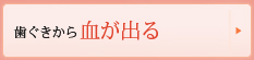 歯ぐきから血が出る、腫れている歯がグラグラする